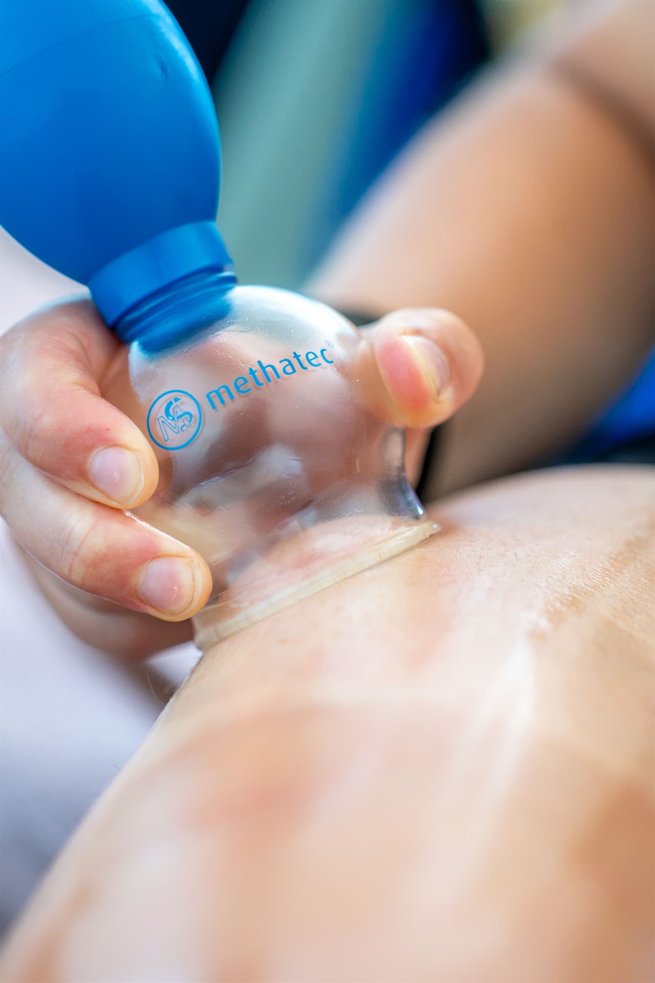 Body release cupping treatment on a leg